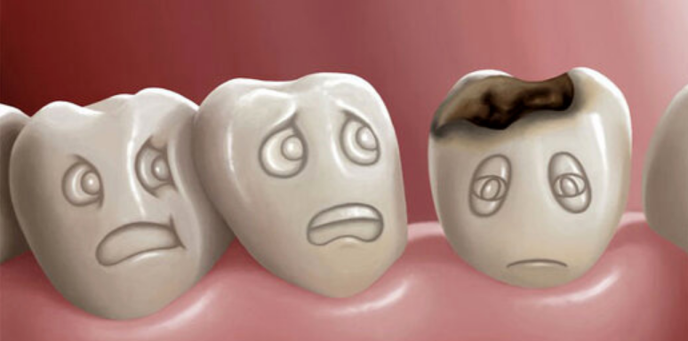 6 عادت ساده که دندان های شما را 100 درصد خراب می کند!