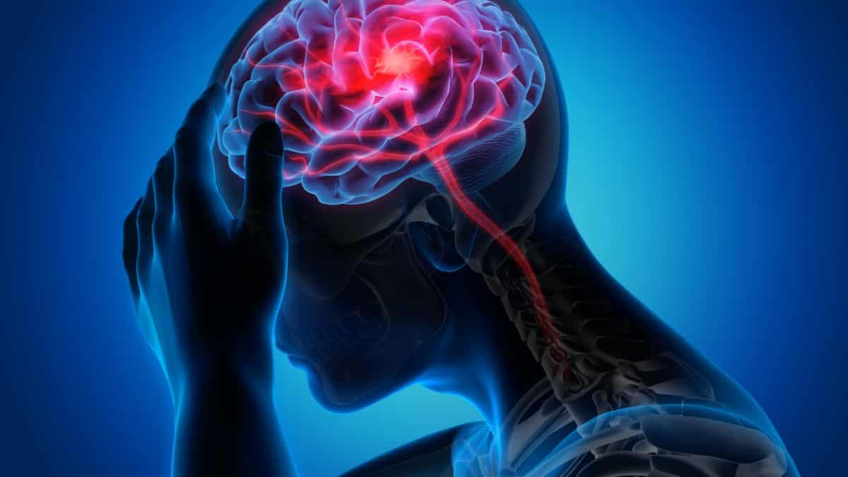 آسیب خفیف به سر می‌تواند سبب سکته مغزی شود؟